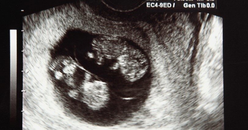 Pregnant mom expecting twins learning what to expect during a twin pregnancy