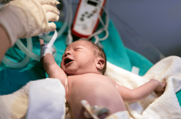 Baby Not Crying After Birth