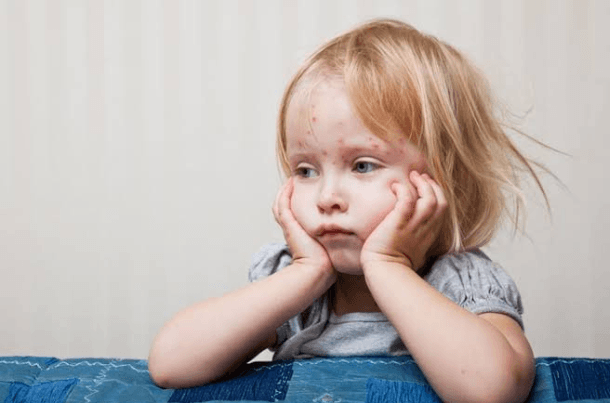 Skin Infections in Children