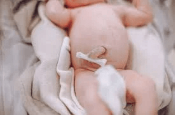 baby belly button sticking out